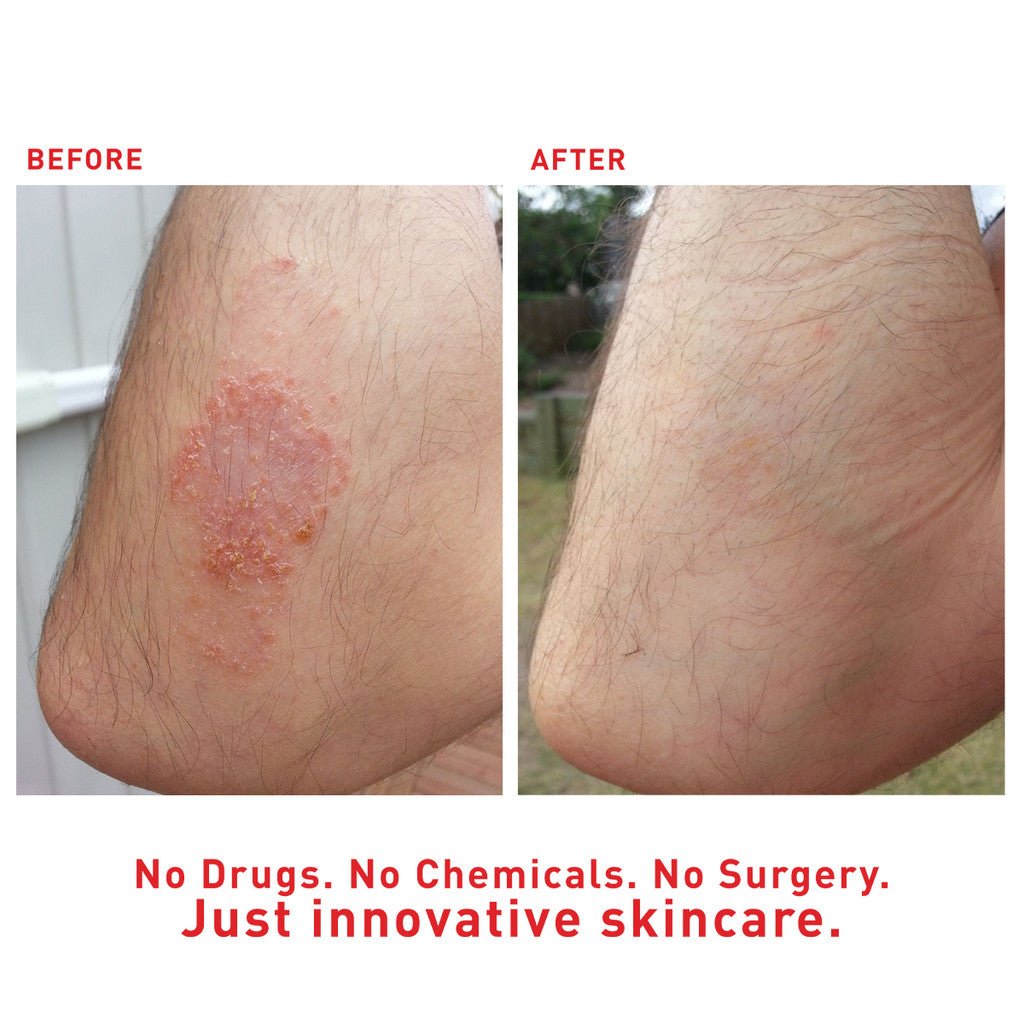 SuperHeal - Woof Living