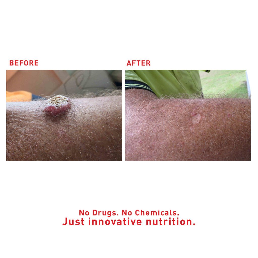 SuperHeal - Woof Living